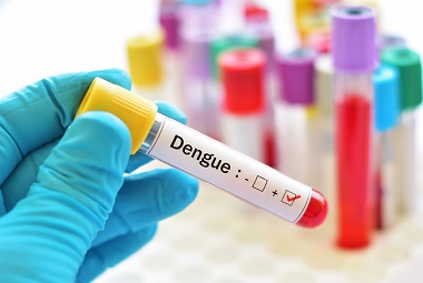 Clicca per accedere all'articolo Casi confermati di dengue con esposizione autoctona