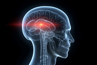 Clicca per accedere all'articolo Varese anni 30 ... 30 anni di Neuroradiologia a Varese